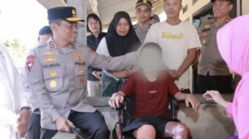 Reaksi Keras Hotman Paris usai Orang Tua Santri Korban Dibakar Senior di Pesantren Menjerit Cari Keadilan
